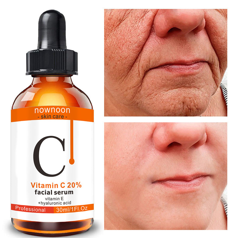 Serum- Vitamin C Facial Serum 30ml